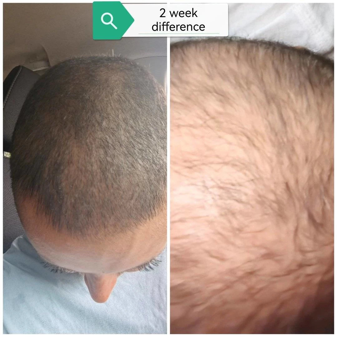 Bóm beauty hair two weeks